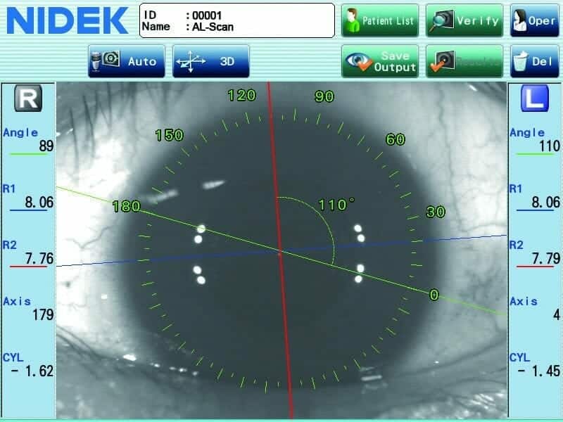 Nidek AL Scan Biometer A Scan 04