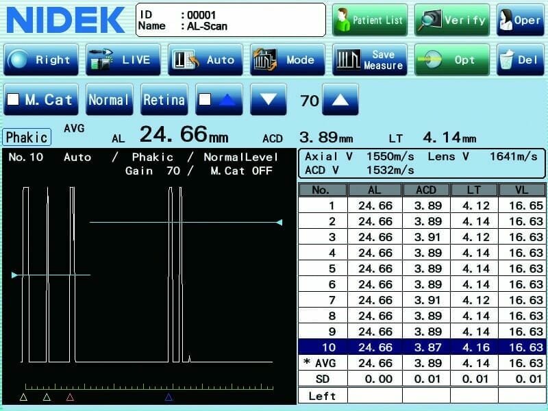 Nidek AL Scan Biometer A Scan 05