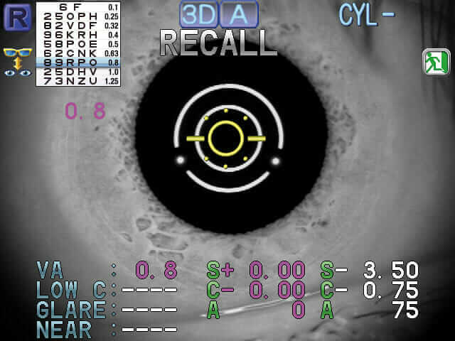 Nidek AR:ARK 1a 03