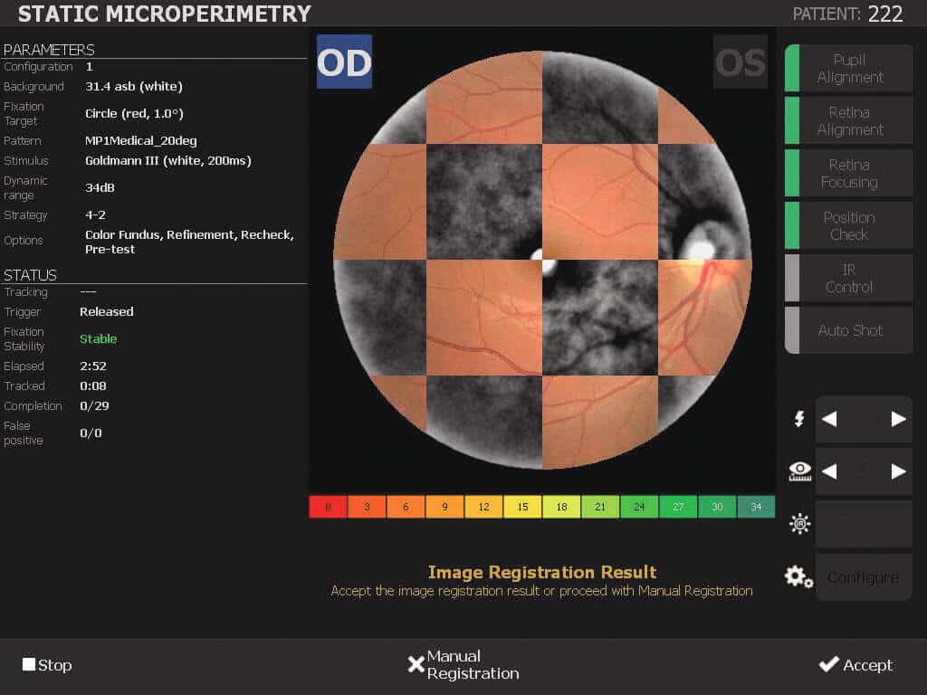 Nidek MP 3 Microperimeter 03