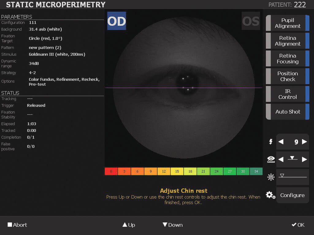 Nidek MP 3 Microperimeter 04