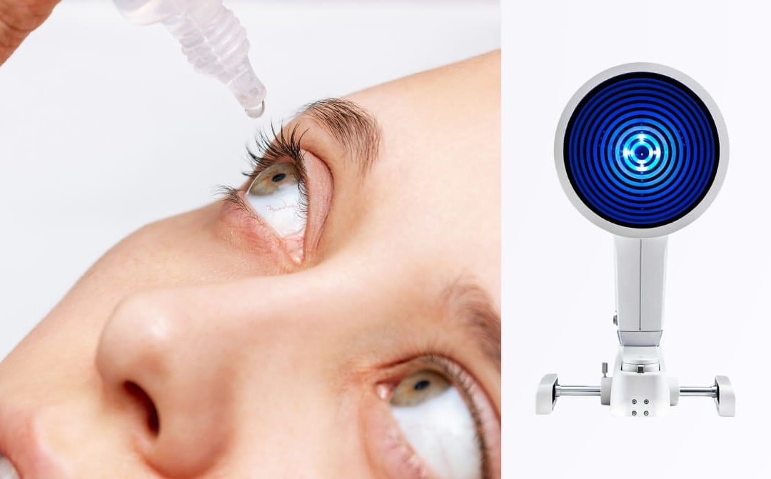 Dry Eye Workshop